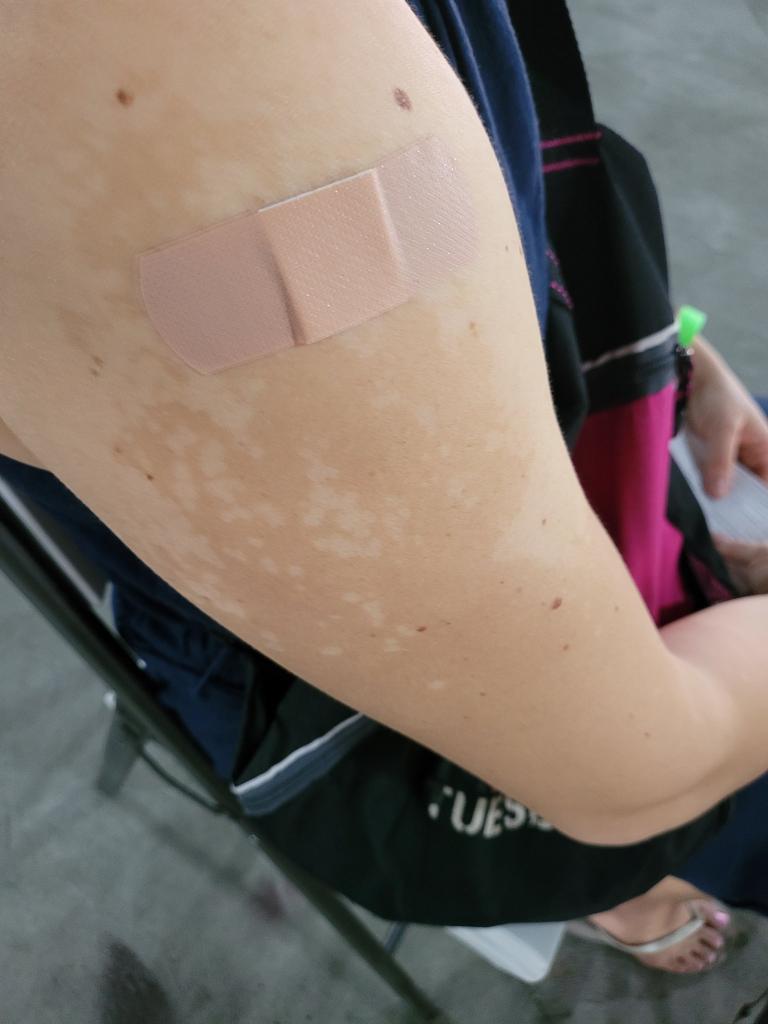Los Angeles County opens Monkeypox vaccine eligibility